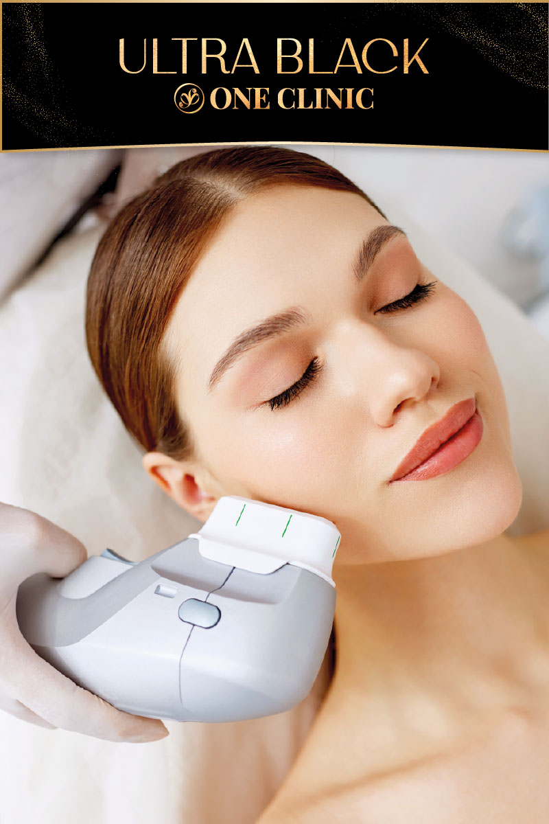 Ultraformer Full Face